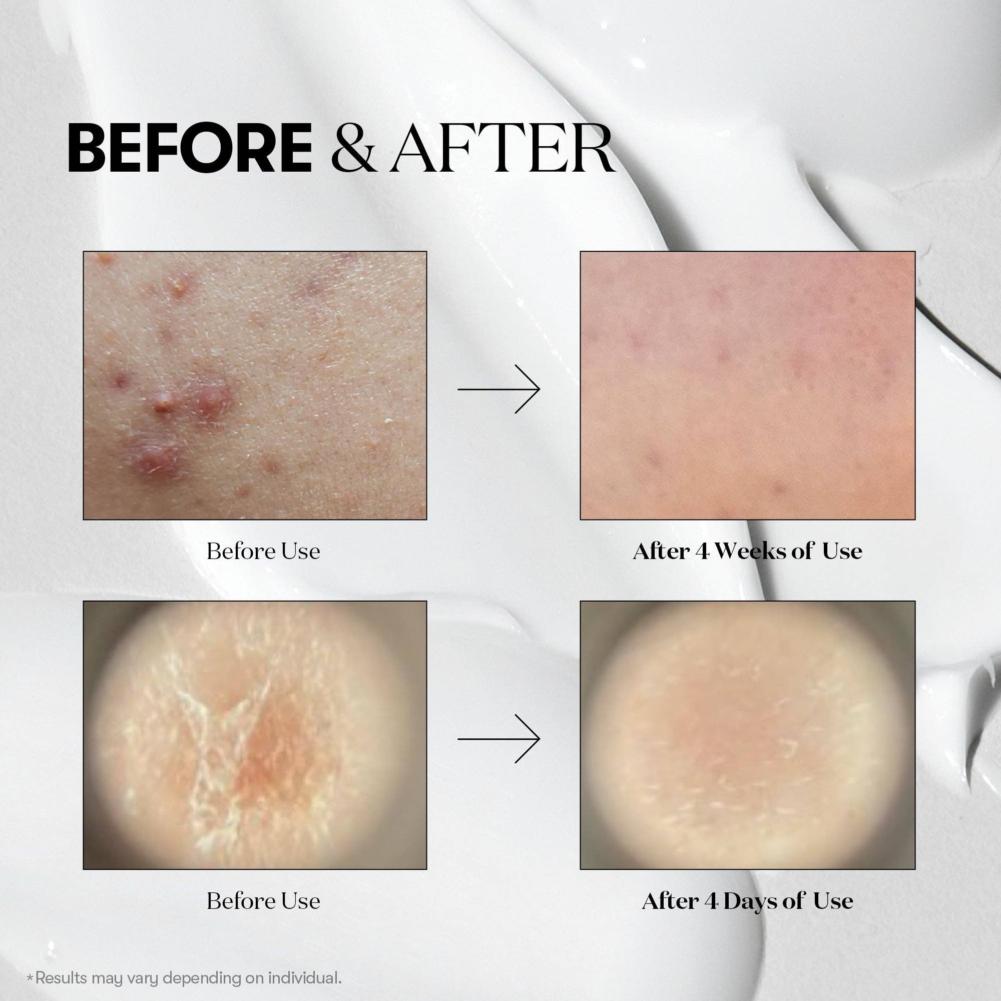 VT Cosmetics Reedle Shot 100 Micro-needle Face Booster - Image 6