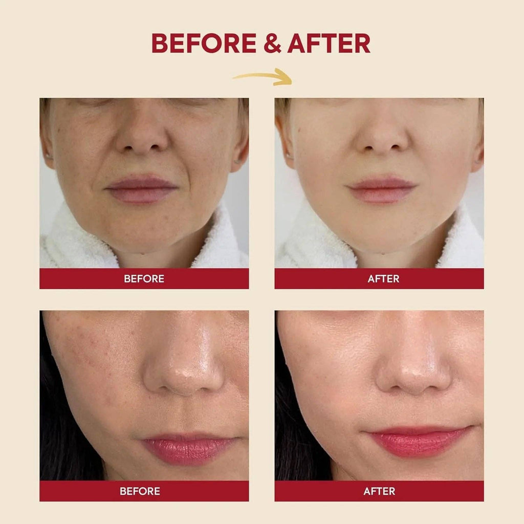 K-Secret SEOUL 1988, Essence : Snail Mucin 97% + Rice - Image 4