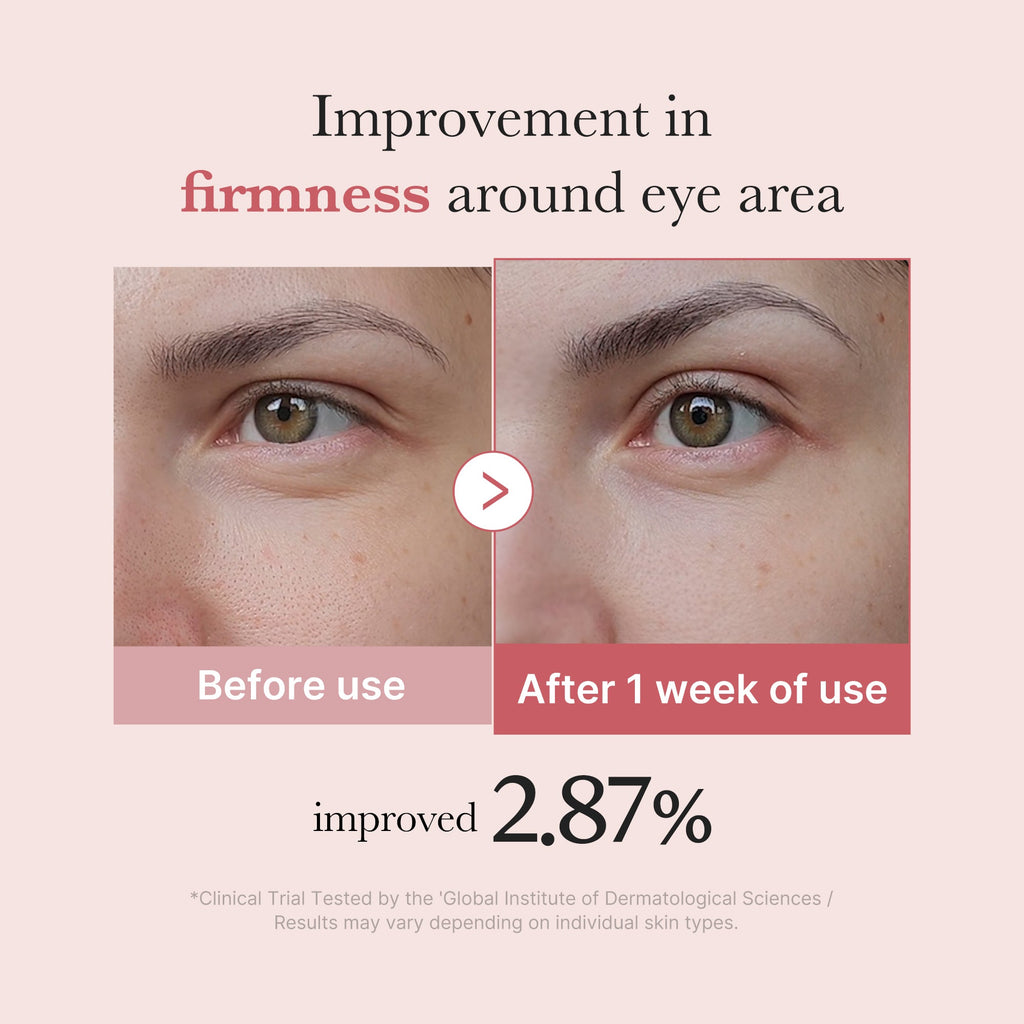 Medicube - PDRN Pink Peptide Eye Cream, 30ml