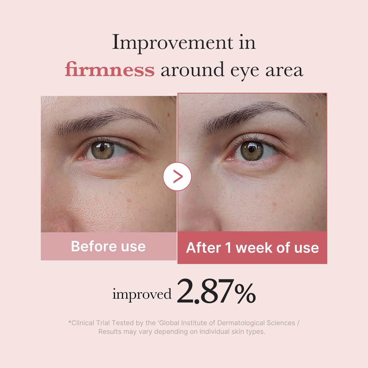 Medicube - PDRN Pink Peptide Eye Cream, 30ml