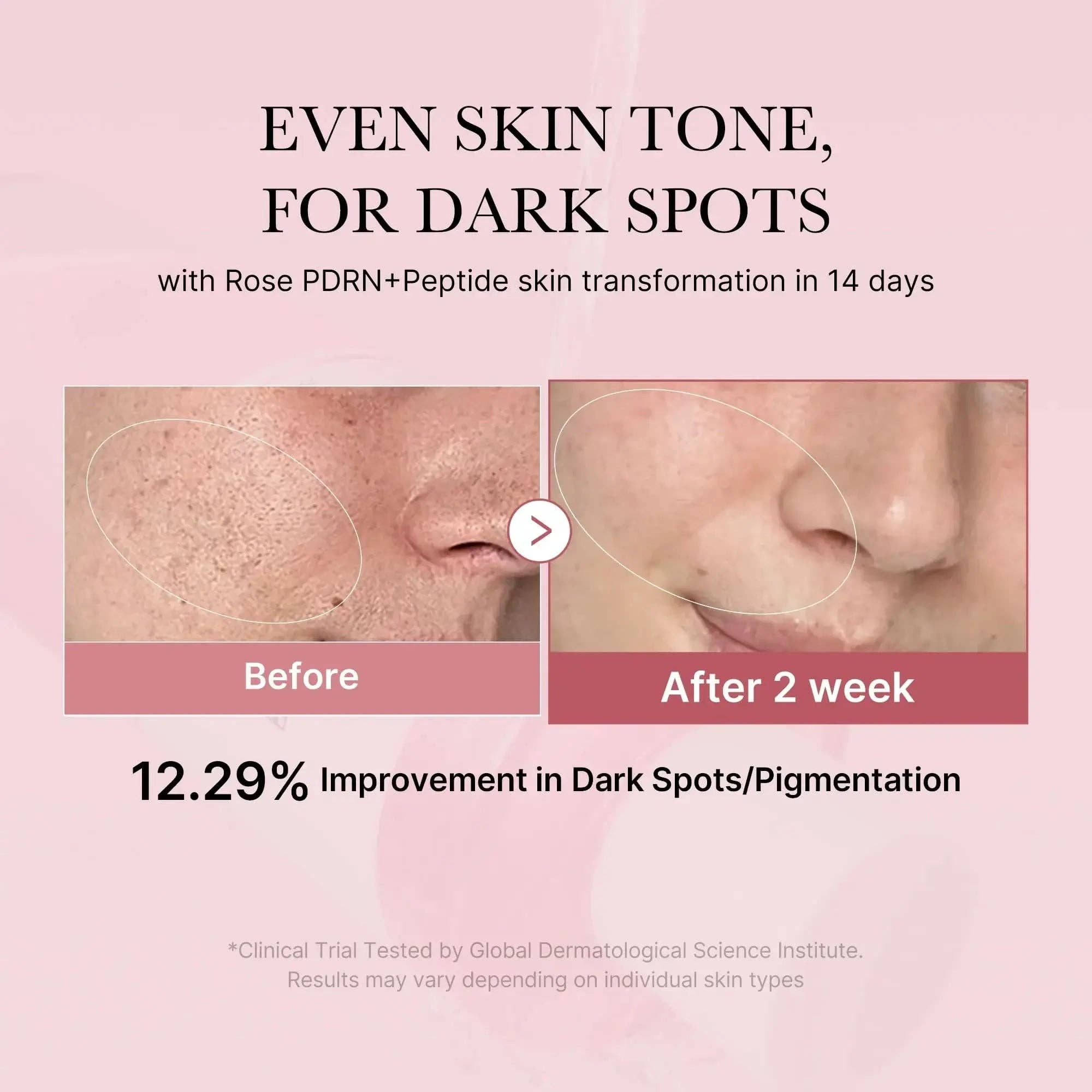 MEDICUBE PDRN Pink Cica Soothing Toner - Image 3