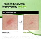 Anua Azelaic Acid 10 Hyaluron Redness Soothing Serum - Image 6