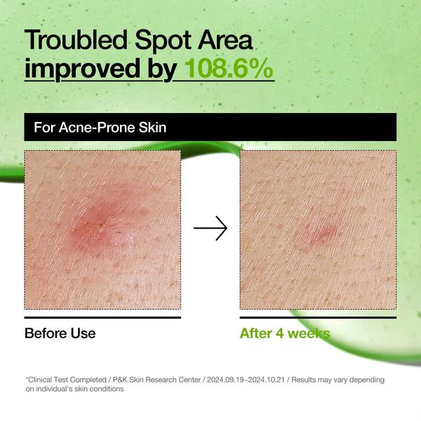 Anua Azelaic Acid 10 Hyaluron Redness Soothing Serum - Image 6