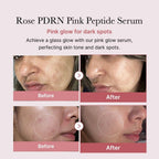 Medicube PDRN Pink Peptide Serum - 30 ml - Image 3