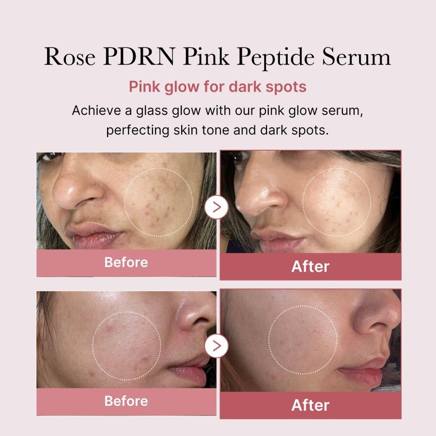 Medicube PDRN Pink Peptide Serum - 30 ml - Image 3